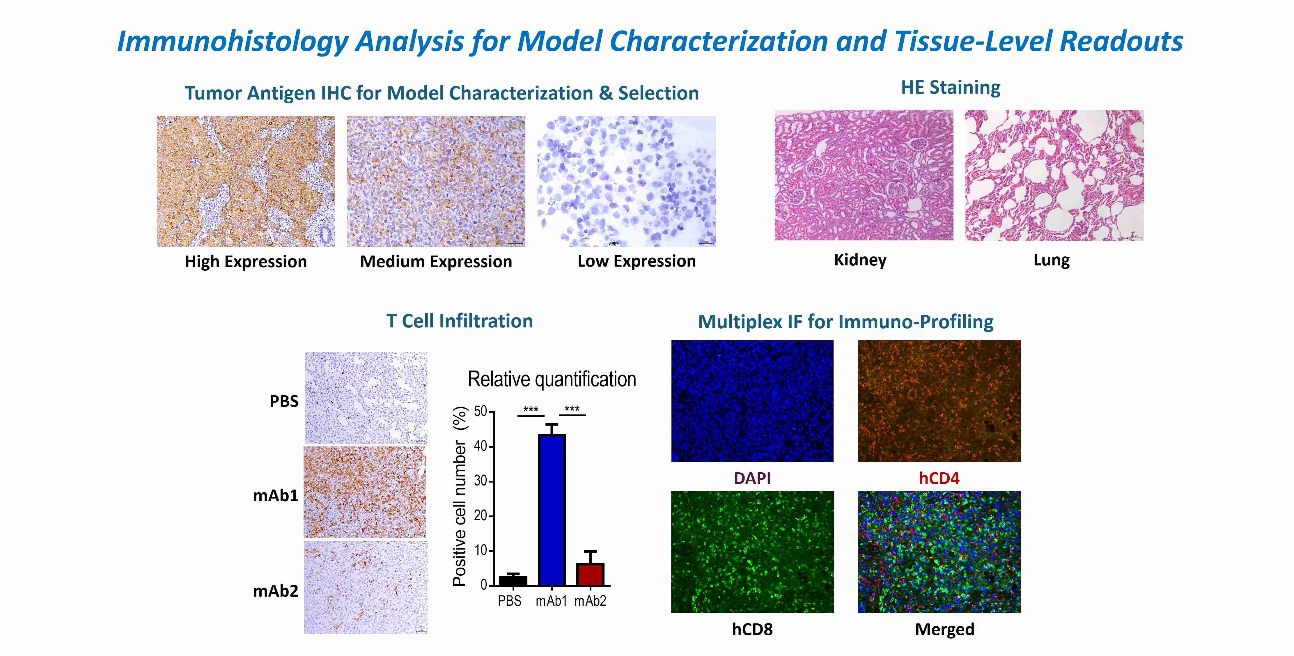 Immunohistology-based tumor model selection and immune profiling